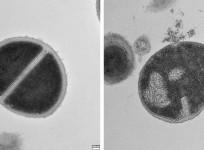 Human body's protein recycling system fights bacteria like antibiotics: Study