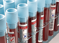 Global HIV funding cuts can cause over 10 mn infections, 3 mn deaths by 2030: Lancet