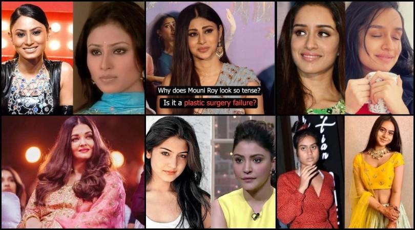 Shraddha Kapoor 's Botox, Nysa's skin whitening, Mouni's Roy 's frozen forehead: Look at celebs who underwent face surgery Shraddha Kapoor 's Botox, Nysa's skin whitening, Mouni's Roy 's frozen forehead: Look at celebs who underwent face surgery