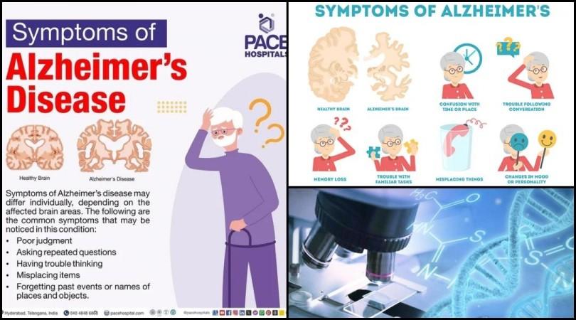 Alzheimer's Gene Therapy Offers New Hope in Preventing Brain Damage Alzheimer's Gene Therapy Offers New Hope in Preventing Brain Damage