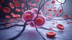 New AI tool analyses DNA for faster, affordable cancer monitoring