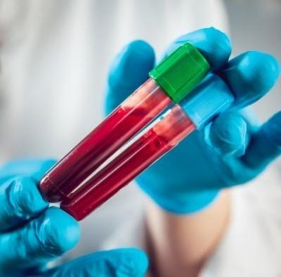 Deadly blood cancer can now be detected early with blood test: Study Deadly blood cancer can now be detected early with blood test: Study