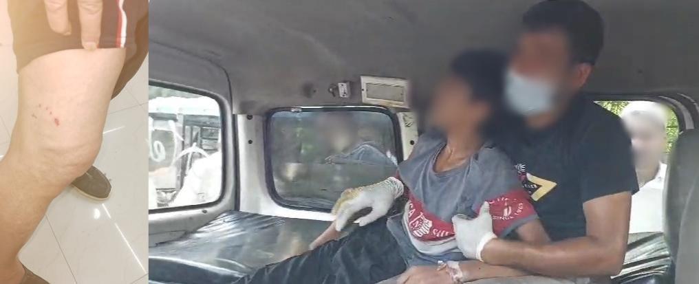 TN issues advisory on Rabies prevention after dog bite deaths in Kerala TN issues advisory on Rabies prevention after dog bite deaths in Kerala