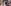 'Why the beauty obsession?': Apoorva Mukhija gets face-lift injections at 24; netizens say she's ruining her youthful skin