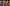 Urfi Javed flaunts swollen face after dissolving lip fillers; Shanaya Kapoor, Sushmita Sen & others who've opted for lip fillers