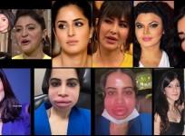Urfi Javed flaunts swollen face after dissolving lip fillers; Shanaya Kapoor, Sushmita Sen & others who've opted for lip fillers