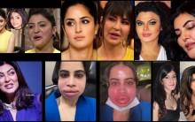 Urfi Javed flaunts swollen face after dissolving lip fillers; Shanaya Kapoor, Sushmita Sen & others who've opted for lip fillers Urfi Javed flaunts swollen face after dissolving lip fillers; Shanaya Kapoor, Sushmita Sen & others who've opted for lip fillers