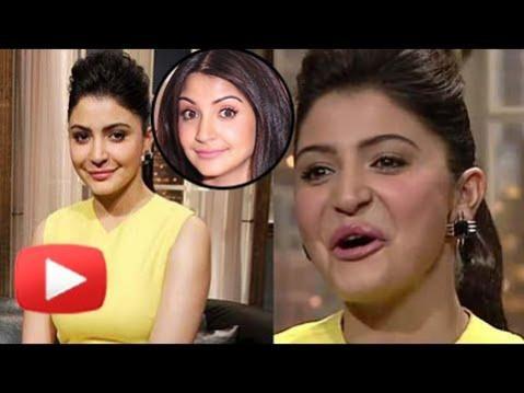 Anushka Sharma opted for temporary lip fillers Anushka Sharma opted for temporary lip fillers