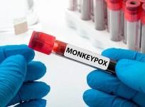 Mpox: 47 countries reported 3,924 cases, 30 deaths in July, says WHO report