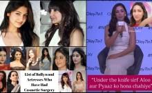 Yami Gautam compares cosmetic surgery to chopping onions and potatoes; fans accuse her of double standards