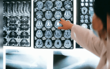 'Brain-Eating Amoeba' Kills 19 In Kerala. How It Spreads, How To Stay Safe