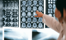 'Brain-Eating Amoeba' Kills 19 In Kerala. How It Spreads, How To Stay Safe