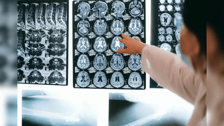 'Brain-Eating Amoeba' Kills 19 In Kerala. How It Spreads, How To Stay Safe 'Brain-Eating Amoeba' Kills 19 In Kerala. How It Spreads, How To Stay Safe