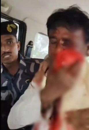 Attack on MP: Delhi BJP leaders hold protest, demand Bengal CM's apology