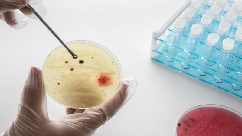 Targeted steroid use shows promise against TB Targeted steroid use shows promise against TB