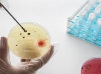 Targeted steroid use shows promise against TB