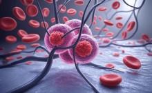 Nanometal particles may offer new way to target cancer cells, research suggests