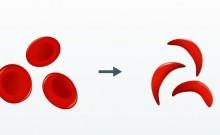 India launches 1st indigenous CRISPR-based gene therapy for Sickle Cell Disease