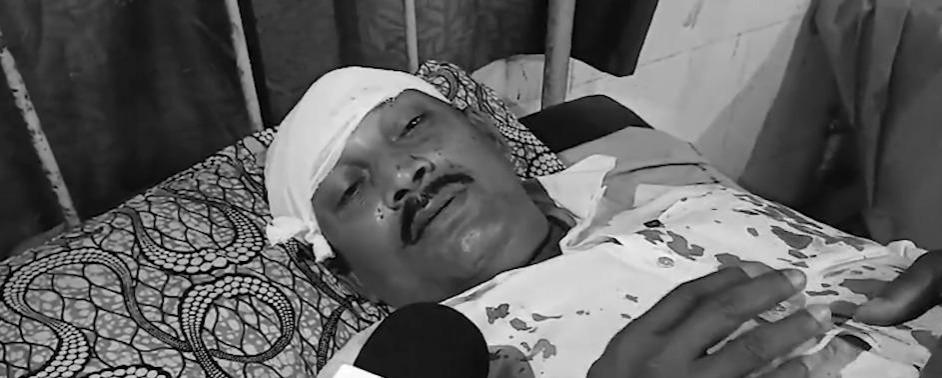'Trinamool miscreants hit me on head with rod': BJP polling agent in Bengal's Nadia 'Trinamool miscreants hit me on head with rod': BJP polling agent in Bengal's Nadia