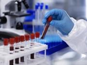 K'taka on high alert after WHO declares Ebola outbreak global health emergency