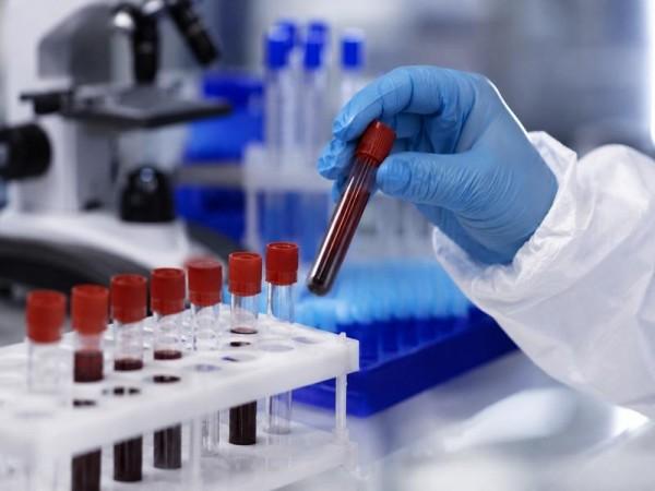 K'taka on high alert after WHO declares Ebola outbreak global health emergency K'taka on high alert after WHO declares Ebola outbreak global health emergency