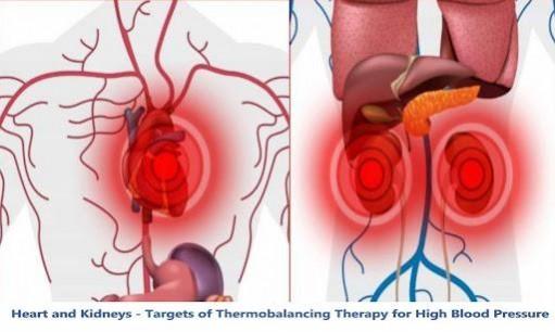 Thermobalancing therapy