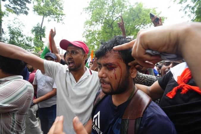 Peaceful CJP protest turns violent: Stone-pelting, tear gas, 50  Delhi Police personnel injured; students lathi-charged | Shocking visuals