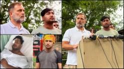 19-years old CJP protester may lose vision after alleged pellet injury during Delhi protest; Police deny using pellet guns