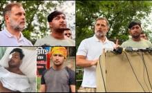 19-years old CJP protester may lose vision after alleged pellet injury during Delhi protest; Police deny using pellet guns