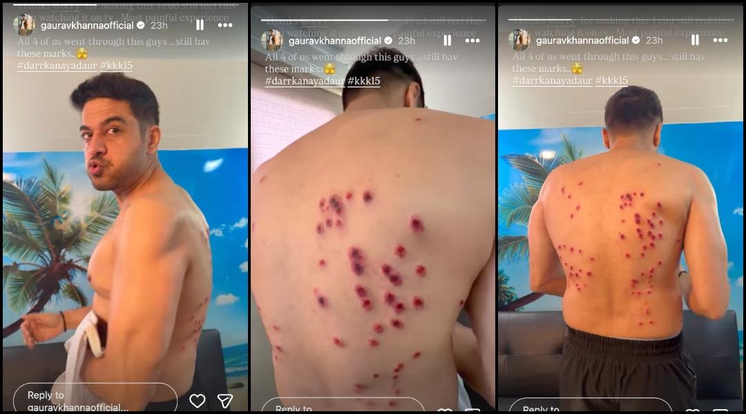 'Same pellet guns as NEET protesters?' : Fans react to Gaurav Khanna's injury on Khatron Ke Khiladi 15; makers clarify, 'It is not at all brutal'