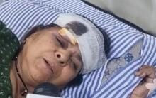 'Was travelling with my husband... don't know where he is now': Victim of Greater Noida bus fire