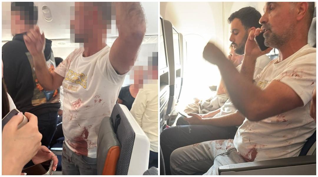 Flydubai FZ1073 hijack scare: Pilot fight, knife attack, blood-stained passenger and emergency landing