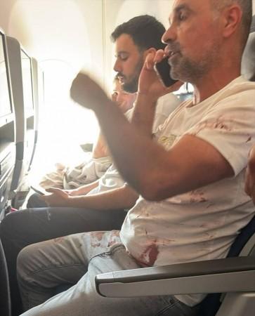 Flydubai FZ1073 hijack scare: Pilot fight, knife attack, blood-stained passenger and emergency landing Flydubai FZ1073 hijack scare: Pilot fight, knife attack, blood-stained passenger and emergency landing