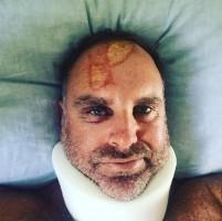 Australian cricket legend Matthew Hayden,Matthew Hayden,Matthew Hayden fractures spine,Matthew Hayden spine,Matthew Hayden injuries,Matthew Hayden injuries pics,Matthew Hayden injuries images
