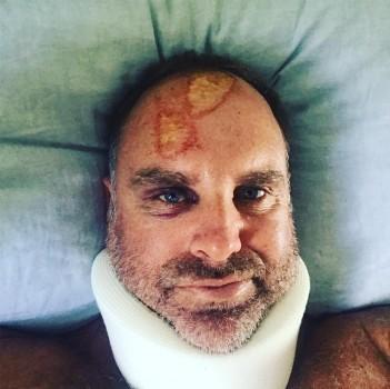 Matthew Hayden fractures spine in surf accident
