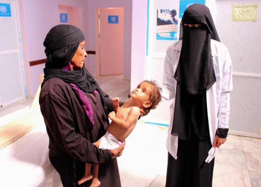Shocking pictures of Yemeni children suffering from malnutrition will break your heart! Yemeni children,Devastating pictures of Yemeni children,Yemeni children malnutrition,malnutrition Yemeni children,malnutrition children