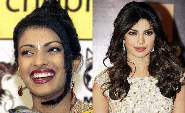 Priyanka Chopra Bollywood Actresses From Ugly To Beautiful,Actresses From Ugly To Beautiful,From Ugly To Beautiful,Bollywood Actresses,actress,actress cute pics,actress latest pics