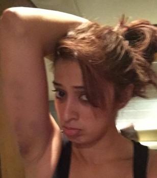 South Indian actress Raai Laxmi was injured during the stunt shooting of her upcoming film 'Sawkarpettai?'