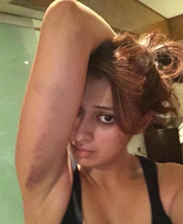 South Indian actress Raai Laxmi was injured during the stunt shooting of her upcoming film 'Sawkarpettai?' Raai laxmi,raai laxmi injured,raai laxmi sawkarpettai,sawkarpettai,sawkarpettai stunt shooting,sawkarpettai actress injured,raai laxmi injured sawkarpettai