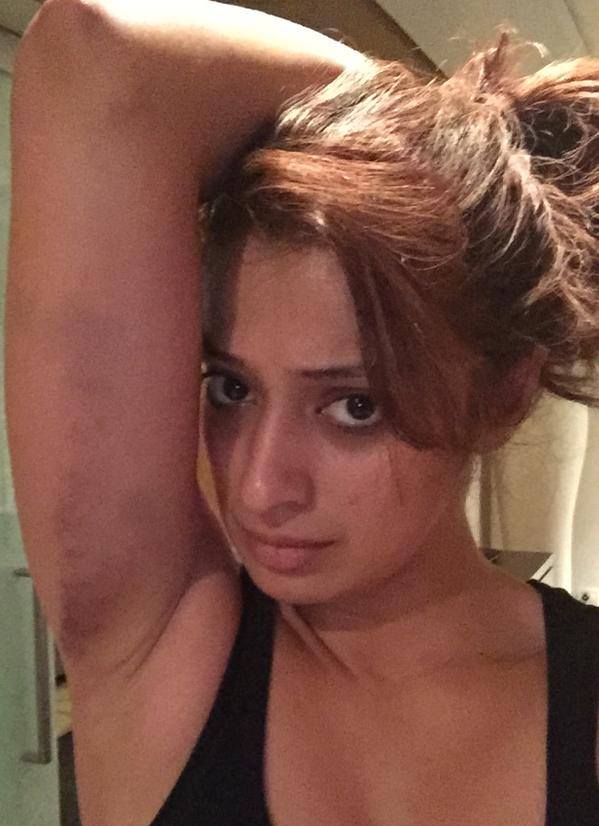 South Indian actress Raai Laxmi was injured during the stunt shooting of her upcoming film 'Sawkarpettai?' Raai laxmi,raai laxmi injured,raai laxmi sawkarpettai,sawkarpettai,sawkarpettai stunt shooting,sawkarpettai actress injured,raai laxmi injured sawkarpettai