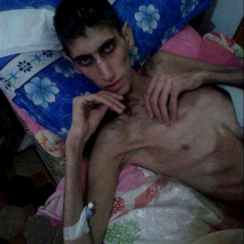 Civilians face starvation, army sieges and displacement in Syria's ongoing war. Syria's humanitarian crisis,Syria,humanitarian crisis,syrian refugees,Civilians face starvation