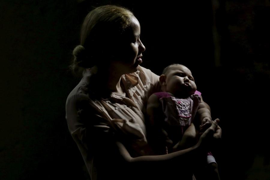 The mosquito-borne Zika virus has been linked to brain damage in thousands of babies in Brazil. Zika virus victims,Zika virus,Zika virus child,Zika virus children,The Zika babies,Zika Virus babies,Zika Virus babies in Brazil,brain damage,mosquito-borne Zika virus,mosquito-borne