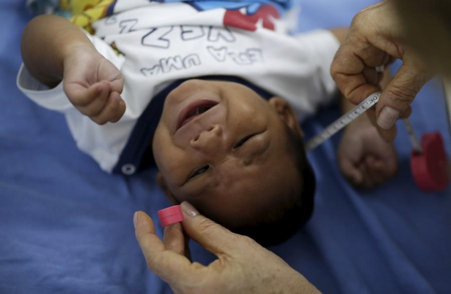 The mosquito-borne Zika virus has been linked to brain damage in thousands of babies in Brazil. Zika virus victims,Zika virus,Zika virus child,Zika virus children,The Zika babies,Zika Virus babies,Zika Virus babies in Brazil,brain damage,mosquito-borne Zika virus,mosquito-borne