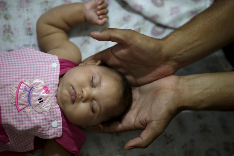 Zika Virus Victims Children Born With Disorders Photosimages