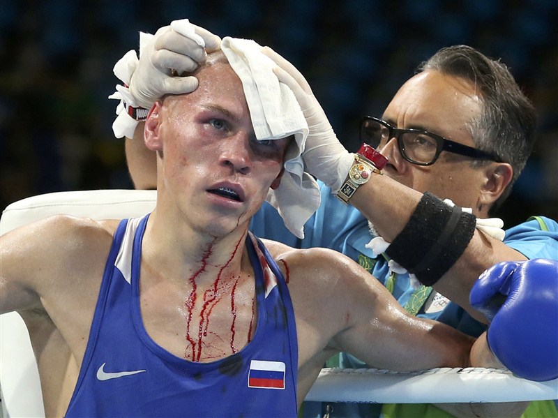 Athletes push their bodies to the limit at the Rio Olympics. Rio Olympics 2016,Rio Olympics,Worst Injuries at Rio Olympics,Worst Injuries at the 2016 Rio Summer Olympics,Summer Olympics,injuries at Rio Olympics 2016,injuries at Rio Olympics,Olympic Injuries