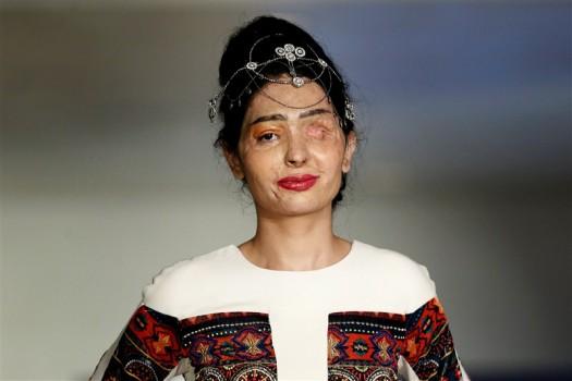 An Indian model scarred in an acid attack challenged perceptions of beauty as she strutted down the runway at New York Fashion Week to promote a ban on the sale of corrosive substances used to maim thousands of women and children each year.