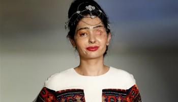 New York Fashion Week,NYFW,New York Fashion Week 2016,Reshma Qureshi,Reshma Qureshi walks ramp,Acid-Attack Survivor Reshma Qureshi,Reshma Qureshi pics,Reshma Qureshi images,Reshma Qureshi New York Fashion Week,Reshma Qureshiphotos,Reshma Qureshi  pictures