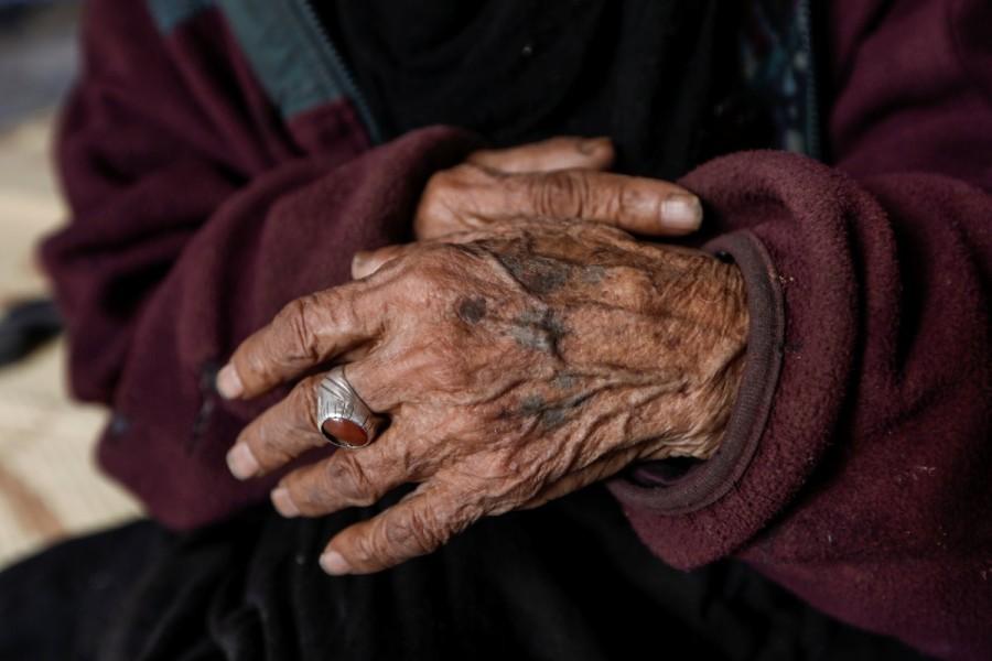 Ninety-year-old Khatla Ali Abdullah hands are seen as she sits at her tent in Hammam al Alil camp while Iraqi forces battle with Islamic State militants, in western Mosul, Iraq. Ninety-year-old Khatla Ali Abdallah,Khatla Ali Abdallah,Mosul,Islamic State