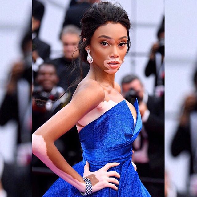 Cannes Film Festival,Cannes Film Festival 2017,Cannes,Cannes 2017,Winnie Harlow,Winnie Harlow at Cannes,Winnie Harlow at Cannes Film Festival,Winnie Harlow pics,Winnie Harlow images,Winnie Harlow stills,Winnie Harlow pictures,Winnie Harlow photos