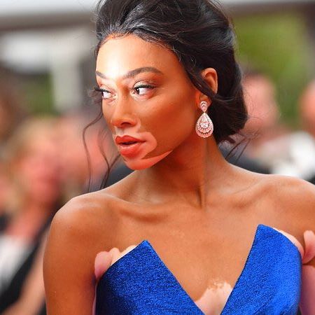 Canadian fashion model Winnie Harlow looks sensational in dramatic sapphire blue gown at Cannes Film Festival. Cannes Film Festival,Cannes Film Festival 2017,Cannes,Cannes 2017,Winnie Harlow,Winnie Harlow at Cannes,Winnie Harlow at Cannes Film Festival,Winnie Harlow pics,Winnie Harlow images,Winnie Harlow stills,Winnie Harlow pictures,Winnie Harlow photos